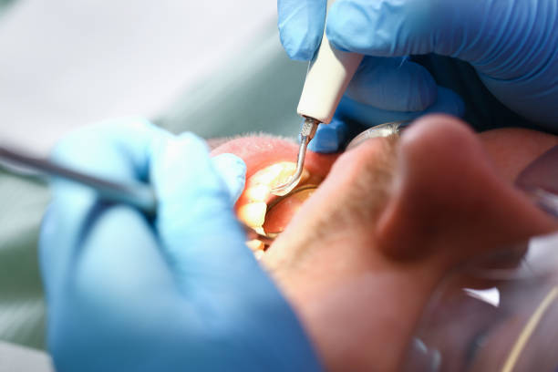 Best Broken or Cracked Tooth Emergency Dentist in Roland, AR