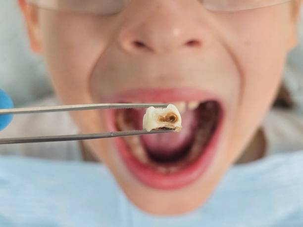 Best Pediatric Emergency Dentist in Roland, AR